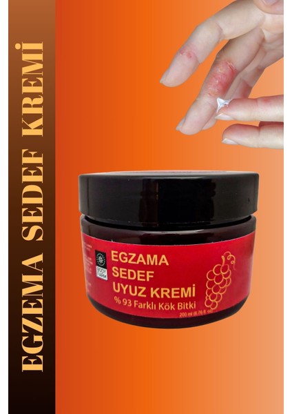 Egzamanıza Sedeflerinize ve Kaşıntılarnıza Karşı Bakım Kremi 200 ml