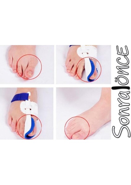 Gece Uyku Parmak Koruyucu fiyatları