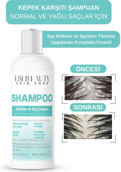 , Kepek Karşıtı ve Dökülme Önleyici Şampuan – Hızlı Uzama, Besleyici ve Güçlendirici Etkili 300 ml
