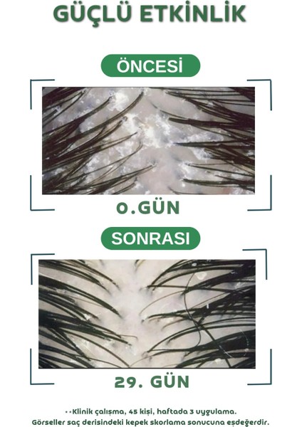 , Kepek Karşıtı ve Dökülme Önleyici Şampuan – Hızlı Uzama, Besleyici ve Güçlendirici Etkili 300 ml modelleri