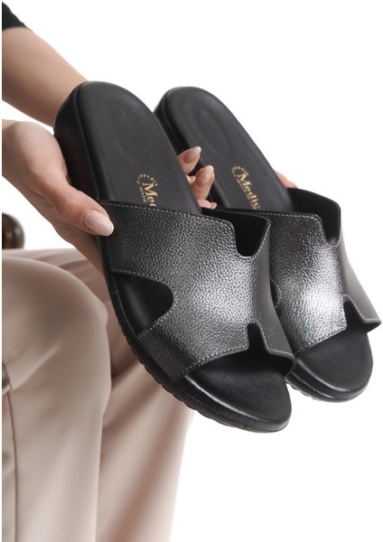 Ortopedik Deri Taban Topuk Dikeni Destekli Desenli Günlük Platin Terlik