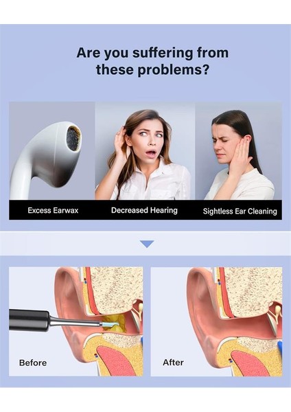 Bebırd T5 3mp Kamera 3.5mm Lens Şarjlı Wıfı Görüntülü Kulak Temizleyici Siyah Renk fiyatları