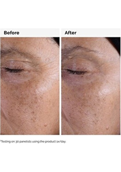 Glikolik Asit 7% Tonik Losyon 240 ml Tüm Cilt Tipleri için Peeling fırsatları