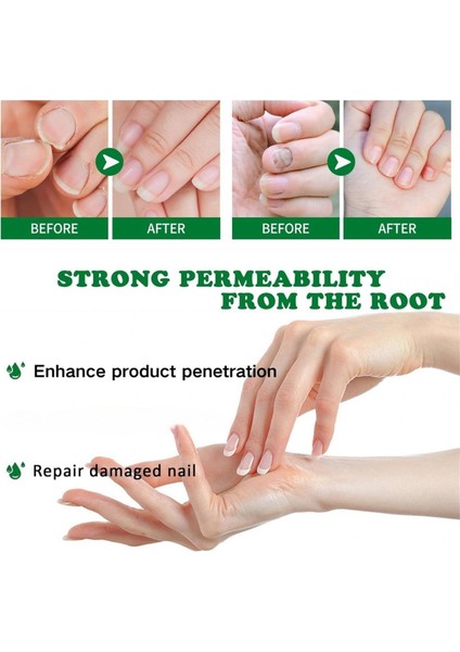 Zencefil Tırnak Bakımı, Çok Amaçlı Tırnak Onarımı, Tırnak Besleyici Yağ Güçlendirici Yağ Essence Zence Tırnak Uzatma Yağı (Yurt Dışından) fırsatları