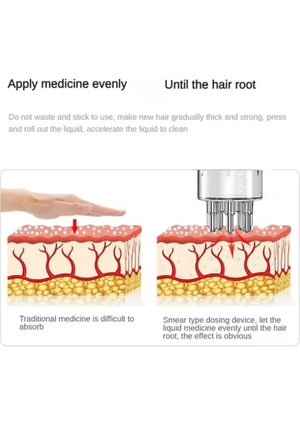 Masaj Fırçalı Saç Derisi Aplikatör Tarağı, Saç Yağı Aplikatör Şişesi, Sıvı Kılavuz Taraklar, Masaj Saç Bakım Aletleri (Yurt Dışından) modelleri
