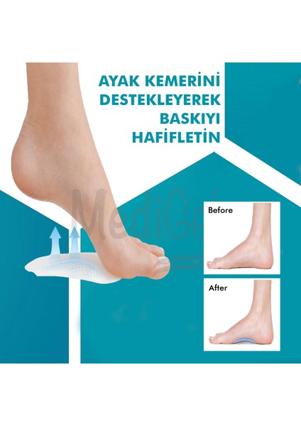 MG09 - Arch Pad Konforlu Ark Bunyon Desteği indirimleri