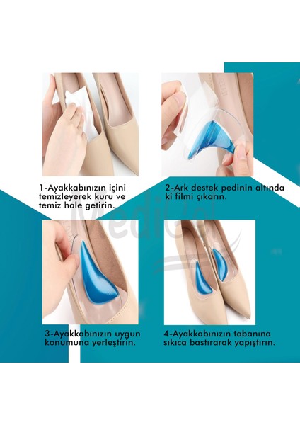 MG09 - Arch Pad Konforlu Ark Bunyon Desteği