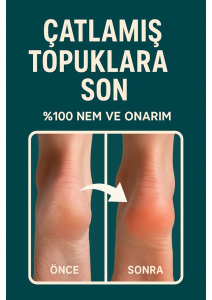 Topuk Çatlak ve Ayak Bakım Kremi - 110ML fırsatları