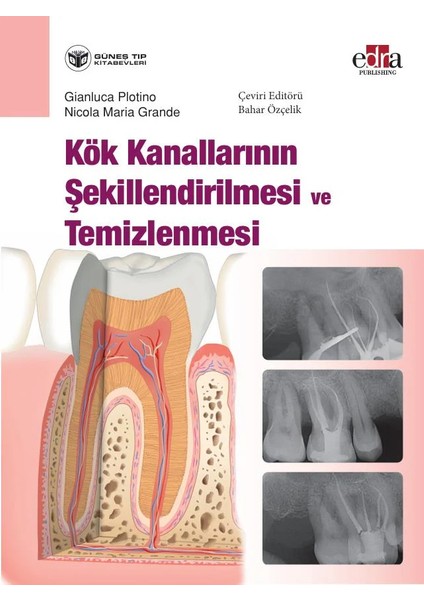 Kök Kanallarının Şekillendirilmesi ve Temizlenmesi fiyatları