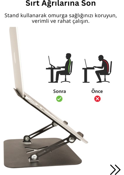 Xleath Tüm Modellerle Uyumlu Katlanabilir Sınırsız Açılı Deri Korumalı Laptop Standı Soğutucu modelleri