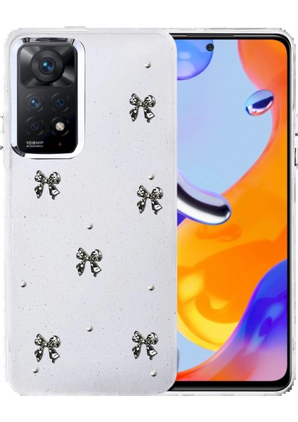 Xiaomi Redmi Note 11 Pro Fiyonk Desenli Kapak - Desen 10-(5796)