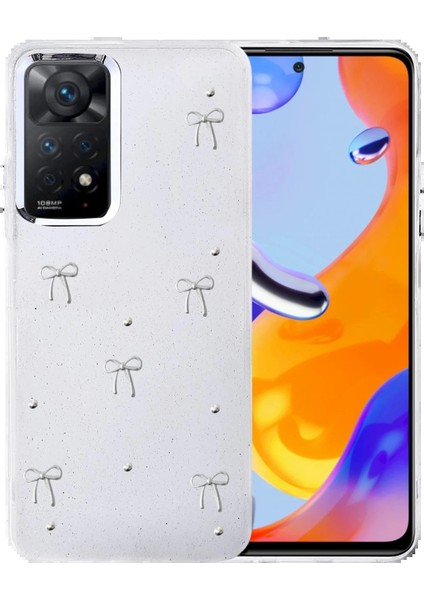 Xiaomi Redmi Note 11 Pro Fiyonk Desenli Kapak - Desen 6-(5796)