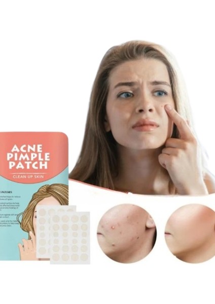 Acne Pimple Master 72 Adet Patch Bandı modelleri