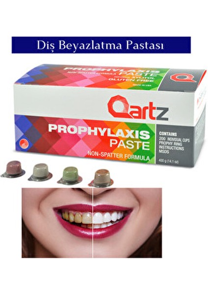 Diş Beyazlatma ve Parlatma Pastası 40 Adet