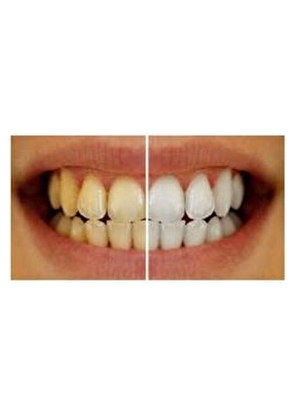 Diş Beyazlatma ve Parlatma Pastası 40 Adet modelleri