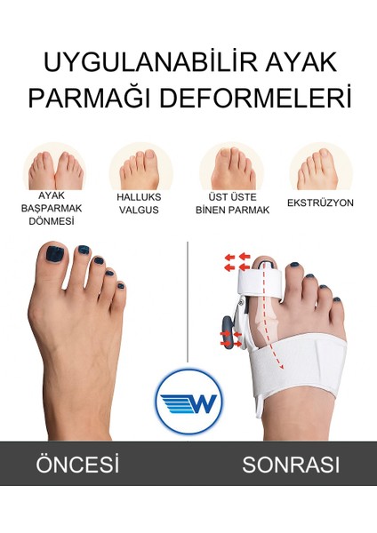 Halluks Valgus Splinti Pratik Sistemli (Tek) W656 modelleri