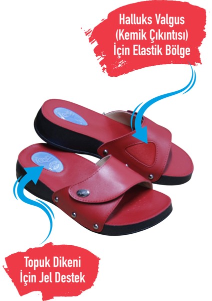 Anatomik Halluks ve Topuk Dikeni Terliği Kemik Çıkıntısı Terliği