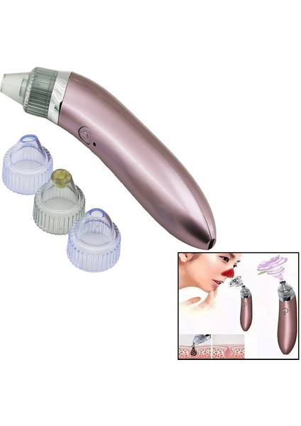 Cilt Bakım Aleti Vakumakne Gözenek Temizleme - Sivilce Çıkarmausb Şarj- 4başlık (5282)