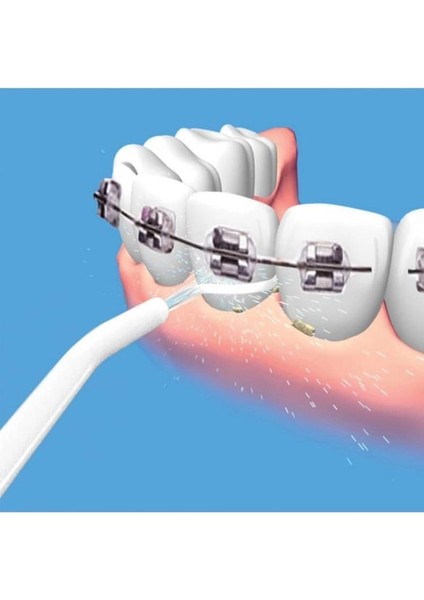 Kulak Temizleme ve Power Floss Diş Temizleme Seti | Mekanik Ağız Bakımı ( Lisinya ) fırsatları