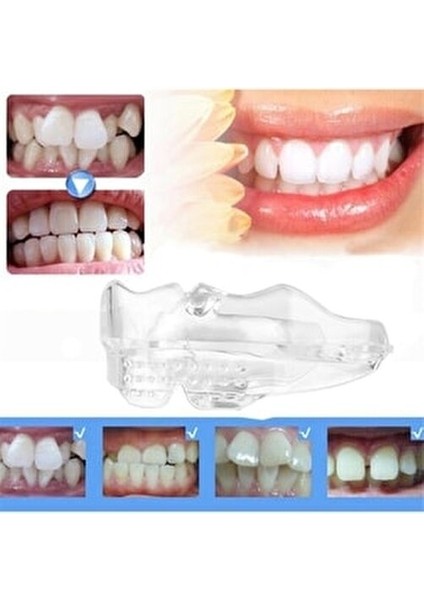 Diş Silikon Ortodontik Parantez Set 3 Lü Yumuşak Orta Sert fiyatları