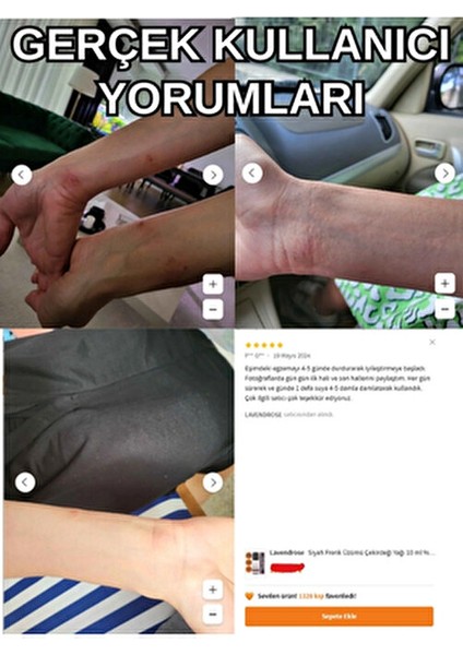 Siyah Frenk Üzümü Çekirdeği Yağı 10 ml %100 Doğal Omega 6 Yağı fiyatları