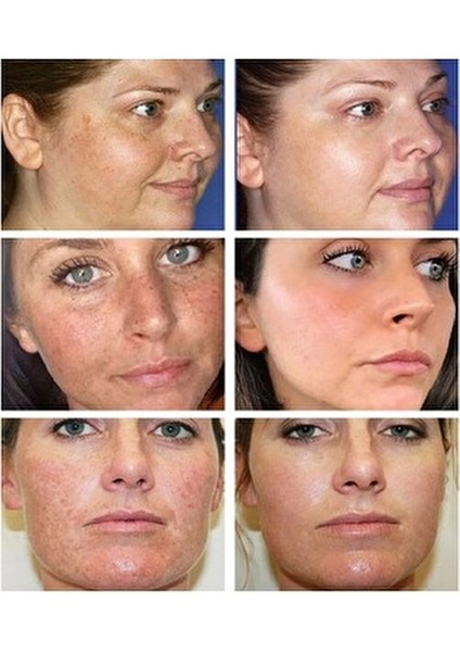 Cilt Beyazlatıcı Vucut Losyonu 550ML fiyatları