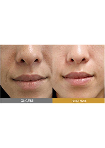 Silk Peptide Intensive Lifting Ampoule/ Ipek Peptitleri ve Kolajen Içeren Ampul 35ML modelleri