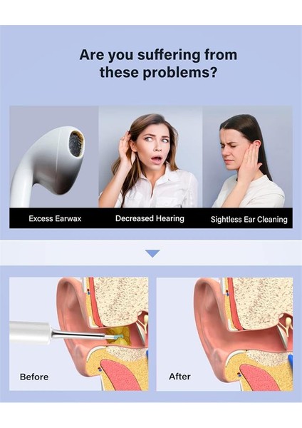Bebırd T5 3mp Kamera 3.5mm Lens Şarjlı Wıfı Görüntülü Kulak Temizleyici Beyaz Renk fiyatları