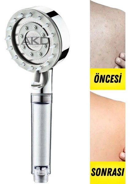 Masaj Başlıklı Filtreli Duş Başlığı + 5 Yedek Filtre | Basınç Artırıcı, Klor ve Kireç Önleyici, Saç ve Cilt Dostu fiyatları