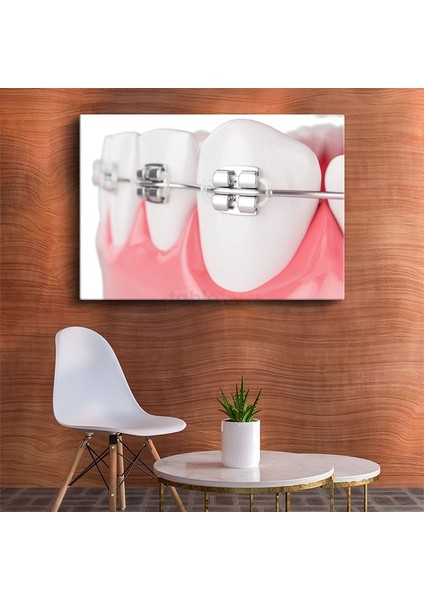 Ortodontist - Ileri Ortodonti Uygulamaları Kanvas Tablo