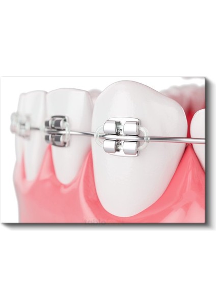 Ortodontist - Ileri Ortodonti Uygulamaları Kanvas Tablo fiyatları