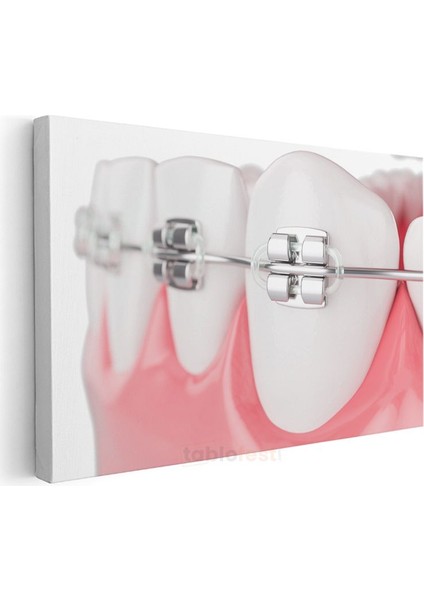 Ortodontist - Ileri Ortodonti Uygulamaları Kanvas Tablo modelleri