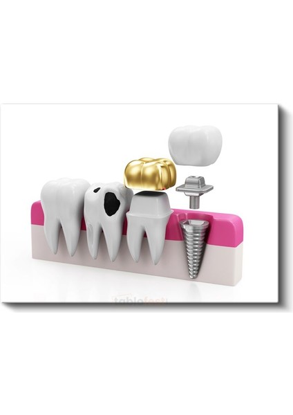 Güneş Enerjisi Uzmanı - Yenilenebilir Enerji Sistemleri Kanvas Tablo fiyatları