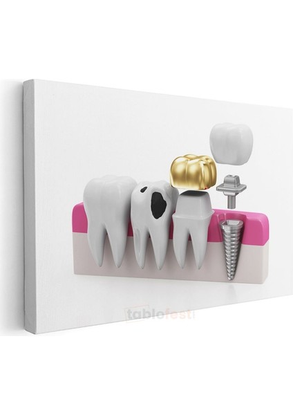 Güneş Enerjisi Uzmanı - Yenilenebilir Enerji Sistemleri Kanvas Tablo modelleri