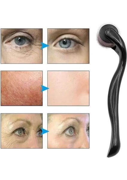 Zengezur Dermaroller Titanyum 540 Iğneli 1 mm Saç Kaş Sakal Serum Kullanıma Uygun modelleri