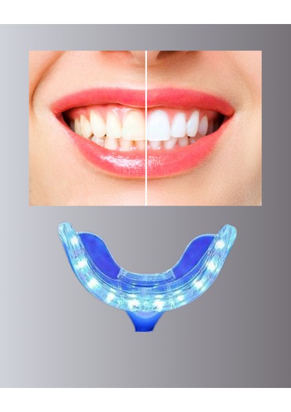 Wizard Beyazlatma Kalemli LED Diş Parlatma Seti fiyatları