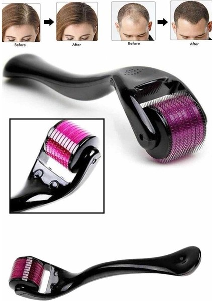 Wizard Derma Roller Titanyum Uçlu 540 Iğneli 1 mm Saç Sakal Çıkarma ve Cilt Bakım Masaj Aleti