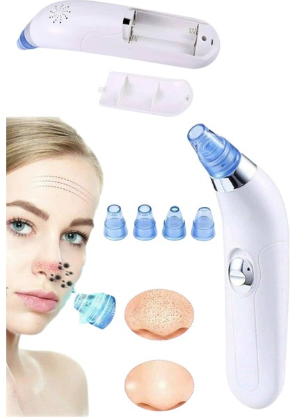 Wizard Vakumlu Siyah Nokta ve Yüz Temizleme Cihazı 4 Başlıklı fiyatları