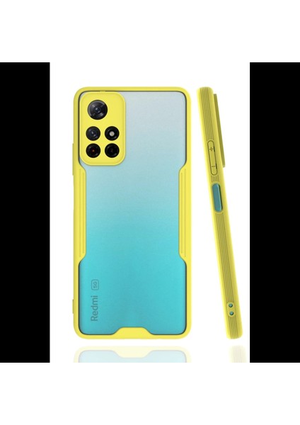 Xiaomi Redmi Note 11T Kılıf Platin Silikon