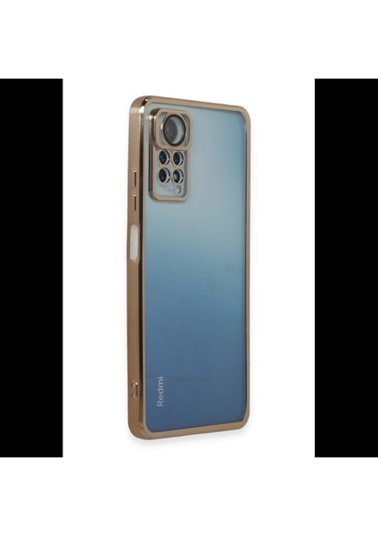 Xiaomi Redmi Note 11 Pro Kılıf Razer Lensli Silikon fiyatları