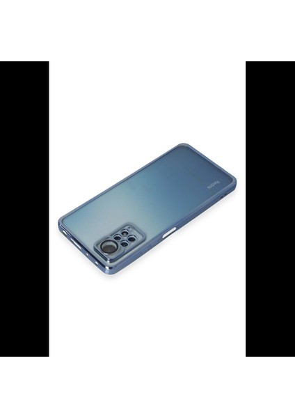 Xiaomi Redmi Note 11 Pro Kılıf Razer Lensli Silikon modelleri