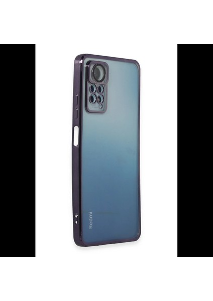 Xiaomi Redmi Note 11 Pro Kılıf Razer Lensli Silikon fiyatları