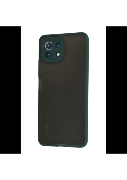 Xiaomi Mi 11 Lite Kılıf Montreal Silikon Kapak modelleri