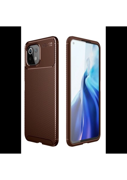 Xiaomi Mi 11 Lite Kılıf Auto Focus Karbon Kapak