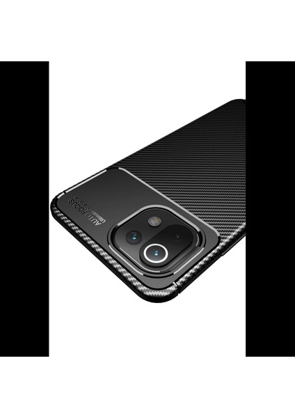 Xiaomi Mi 11 Lite Kılıf Auto Focus Karbon Kapak modelleri