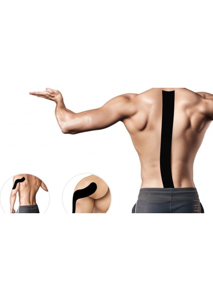 Siyah Sporcu Ağrı Bandı Kas ve Eklem Ağrıları Için Yüz & Vücut Uyumlu Esnek ve Nefes Alabilir 5x5 cm fiyatları