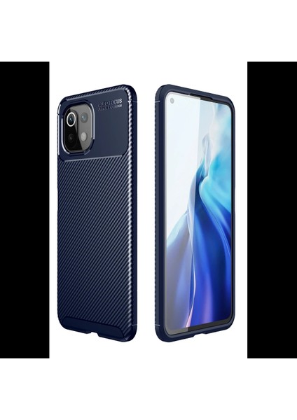 Xiaomi Mi 11 Lite Kılıf Auto Focus Karbon Kapak