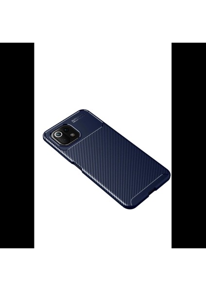 Xiaomi Mi 11 Lite Kılıf Auto Focus Karbon Kapak fırsatları