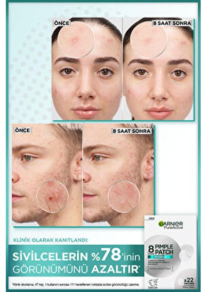 Pimple Patch 22 Adet Akne Karşıtı Bant Tüm Cilt Tipleri İçin 8 Saat Etkili