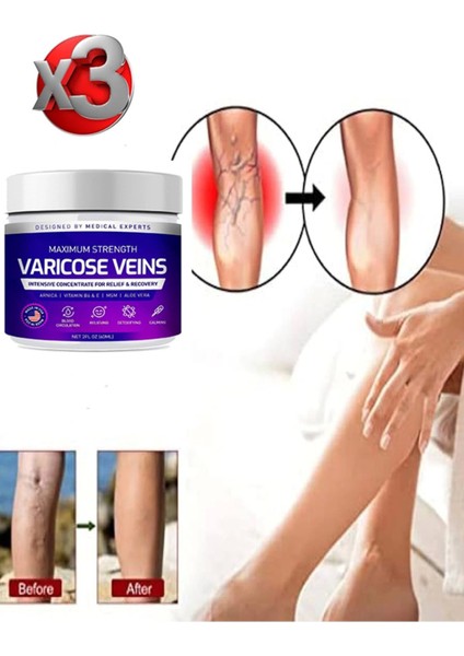 Maximum Strength Varicose Veins Bakım Kremi 100 ml x 3 Adet